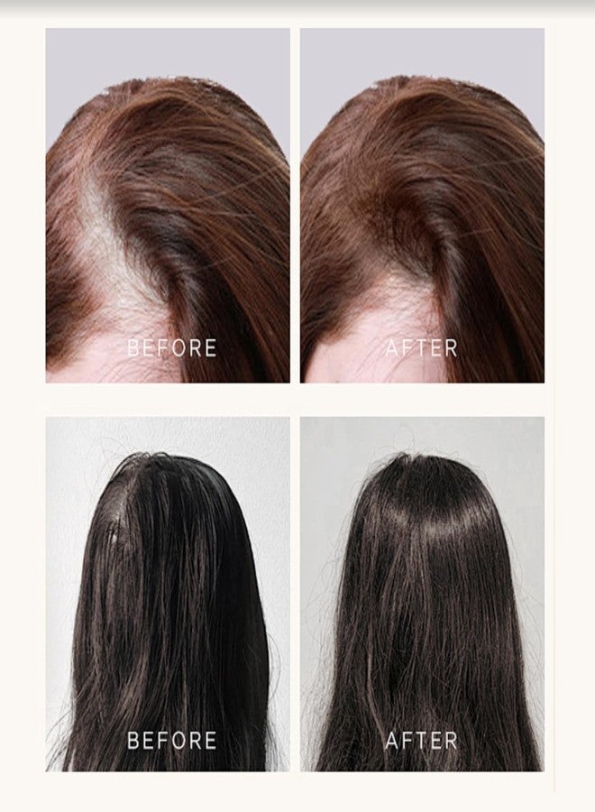 GROEI Scalp Hair Growth Serum for Thinning Hair – Niacinamide & Panthenol Formula for Stronger-Looking Strands: Lightweight Daily Scalp Treatment for Men & Women, 20ml (2PCS) - Image 4